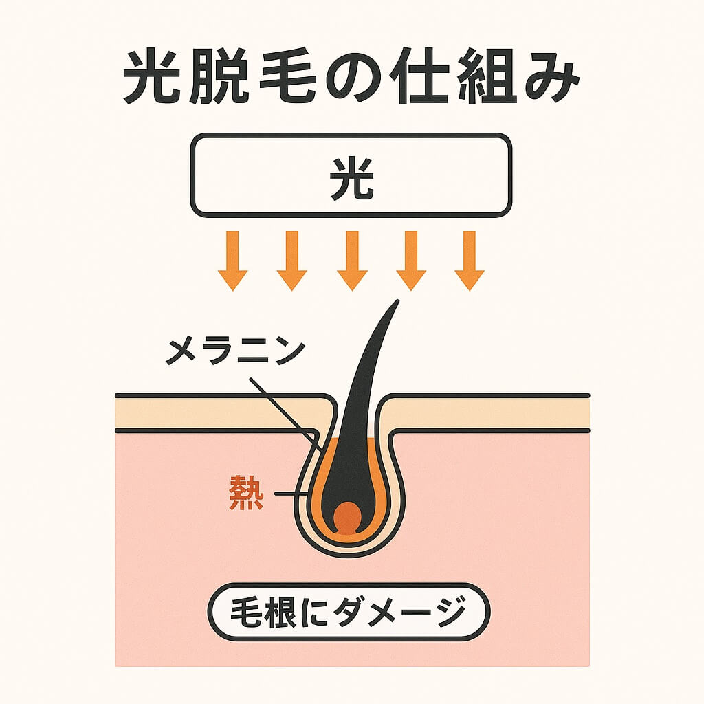 light-dastumou-image