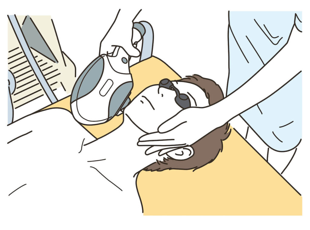 ヒゲ脱毛のイメージ