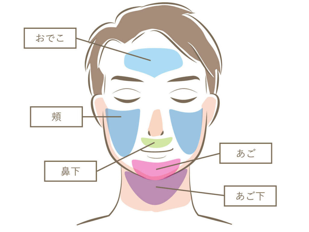 ヒゲ脱毛の部位