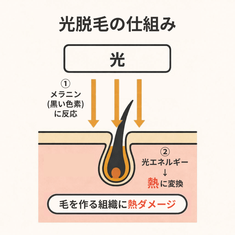 光脱毛の仕組み